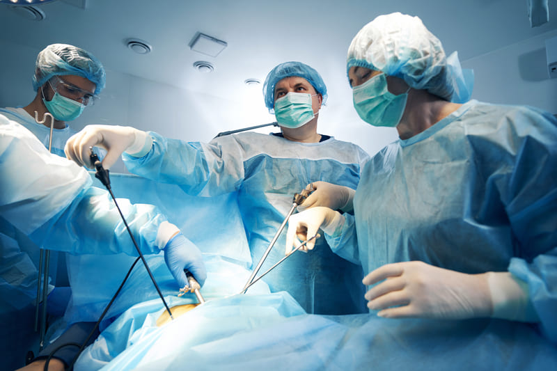 chirurgie laparoscopica