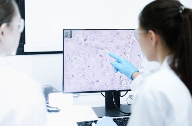 medici examineaza celule
