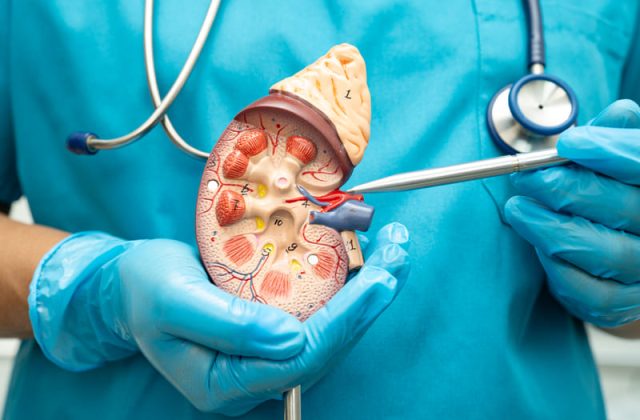 medic arata unde se intervine in pieloplastie
